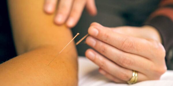 Acupuncture & IMS Surrey service photo